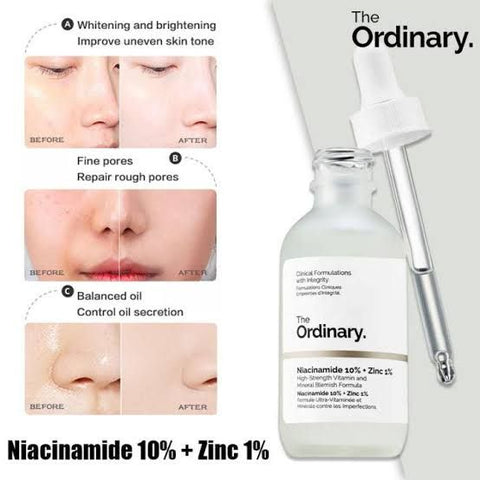 ORDINARY Niacinamide 10% + ZINC 1% 30ml